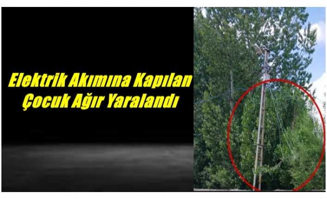 Ağrı'da Elektrik Akımına Kapılan Çocuk Ağır Yaralandı